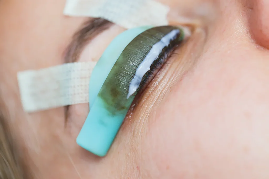 Göz Kapağı Estetiği Nedir (Blefaroplasti)