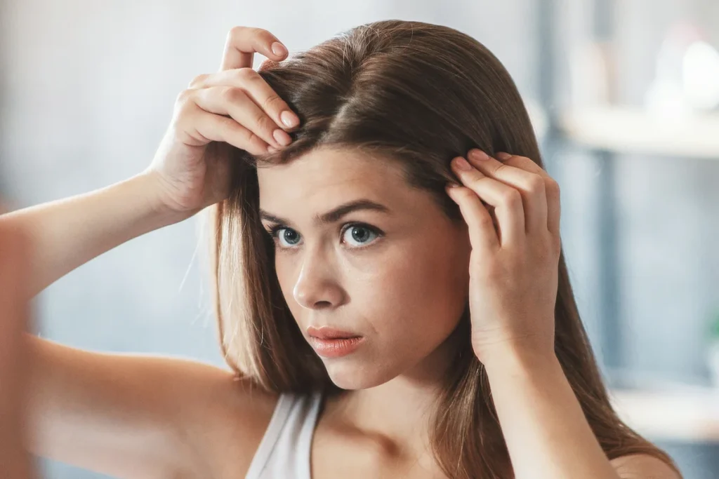 Saç Derisinde Egzama Tedavisi ve İyi Gelen Yöntemler