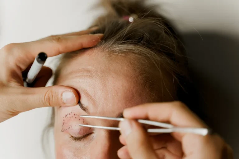 Universay Didim Hastanesi - Göz Kapağı Estetiği (Blefaroplasti)