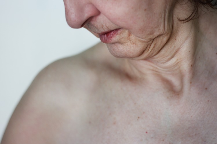 Deri Sarkması Ameliyatı Nasıl Yapılır? Kimler İçin Uygundur?