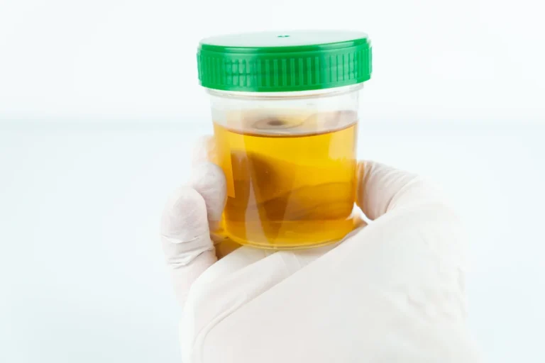 İdrar Rengi Hakkında Bilmeniz Gerekenler