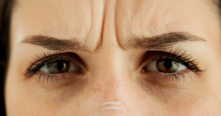 Kaş Arası Dolgu Nedir Nasıl Yapılır