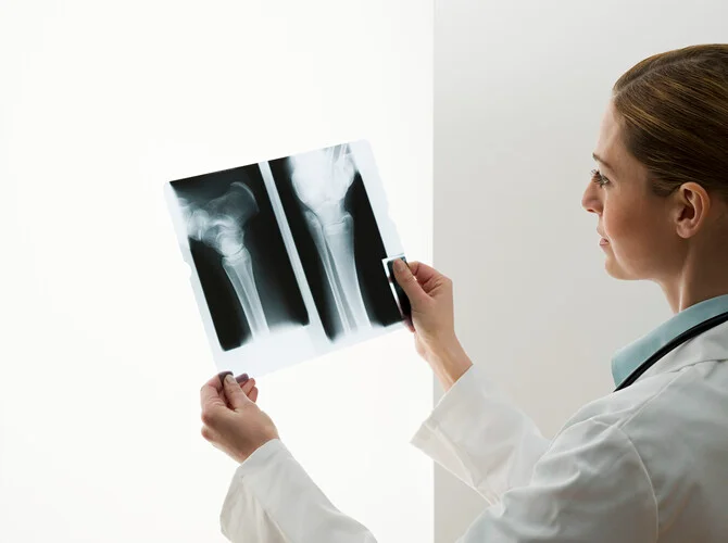 Kemik Kırığı İyileşme Süreci Ve Yapılması Gerekenler