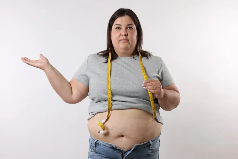 Obezite Tedavisi Nedir Obezite Nasıl Tedavi Edilir