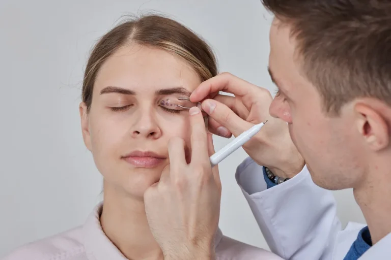 Üst Göz Kapağı Ameliyatı Nedir Nasıl Yapılır ve Süreç Nasıldır