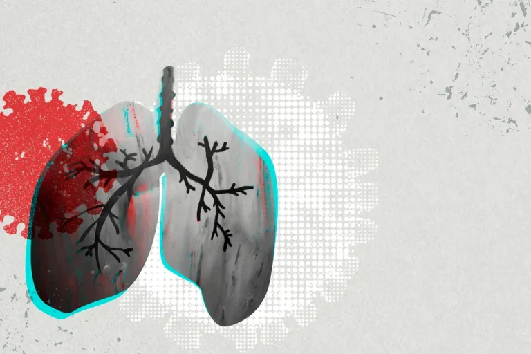 Akciğer Kanseri Belirtileri ve Tedavi Yöntemleri