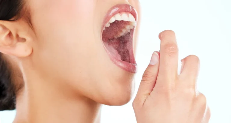 Ağız Kokusu Neden Olur? Ağız Kokusu Nasıl Geçer?