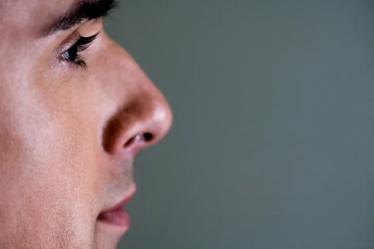 Burun Eğriliği Nedir?